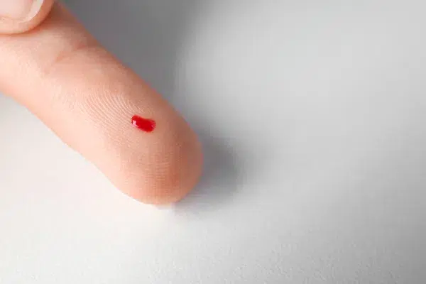 un gros plan d'un doigt avec une goutte de sang sur un fond blanc.