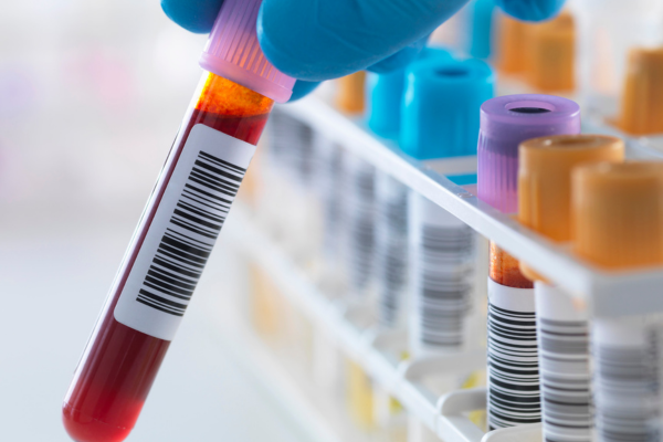a close-up of a gloved hand holding a test tube containing a blood sample. The test tube is labeled with barcode for identification and tracking purposes.